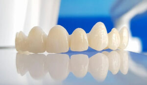 كل ما تود معرفته عن تركيبات الأسنان: الأنواع والفوائد والمخاطر